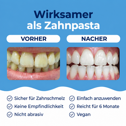 ALIPS® PAP+ Zahnaufheller
